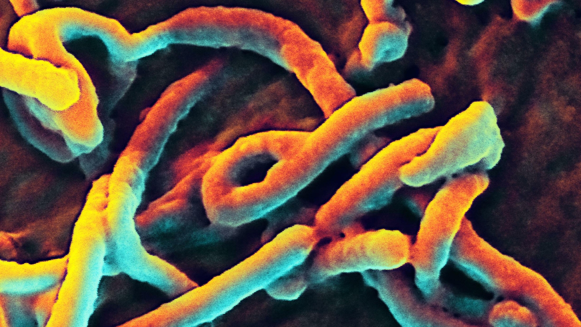 Potential case of deadly Ebola being probed after hospital clinic 'locked down'