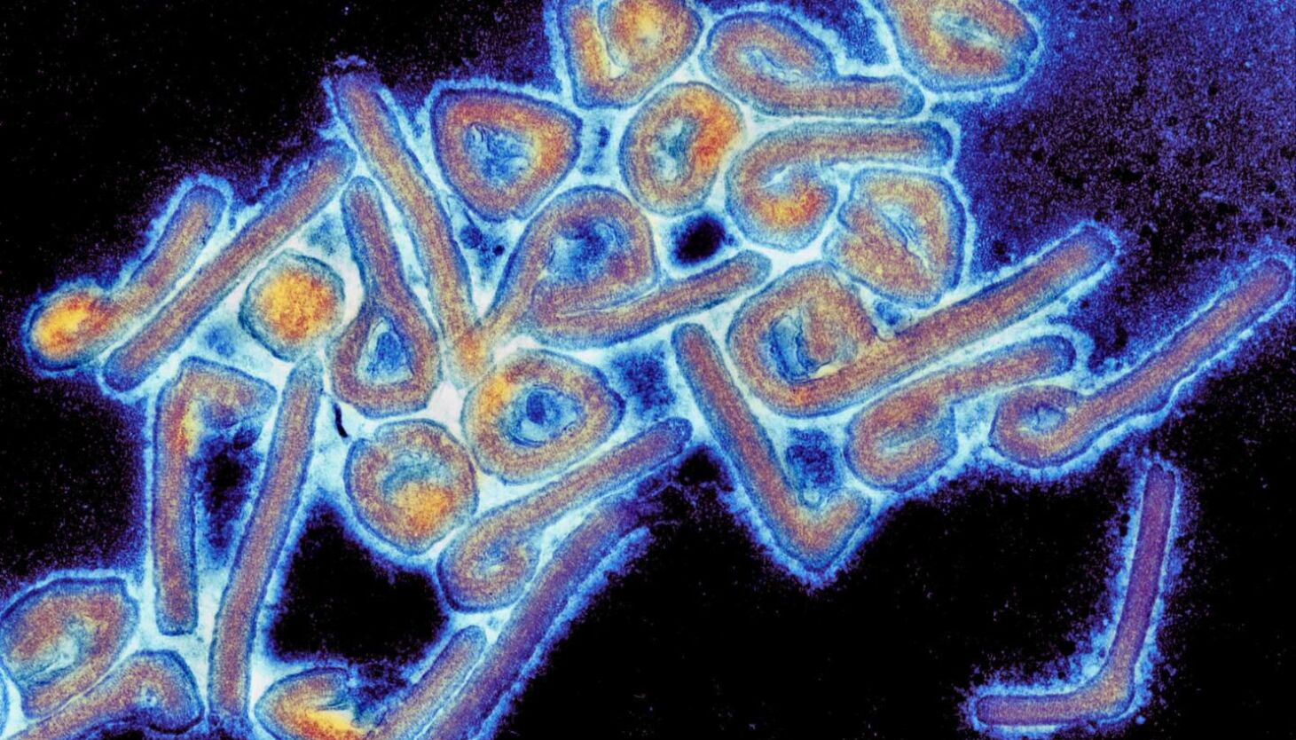CDC warns U.S. doctors against Marburg virus after Africa outbreaks