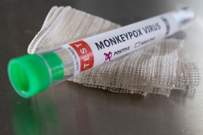 Health Ministry records two monkeypox cases