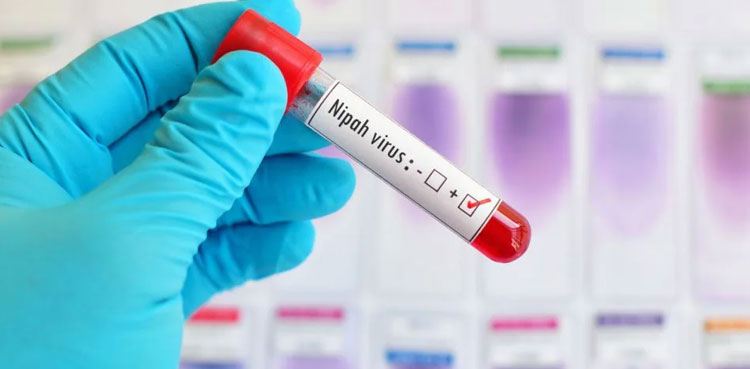 Nipah virus: NIH issues advisory for general public