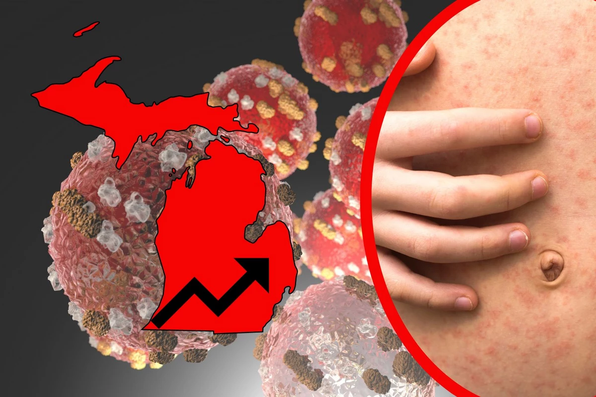 The CDC Warns That This Virus is Rearing Its Ugly Head in Michigan